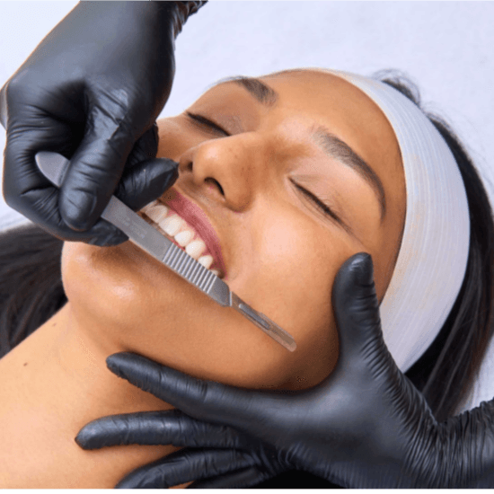 Dermaplaning Series at Bare+Skin in Shreveport, LA