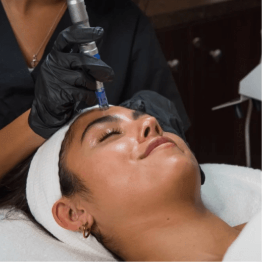 Microneedling Facial at Bare+Skin in Shreveport, LA