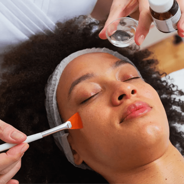 Corrective Chemical Peel Series at Bare+Skin in Shreveport, LA