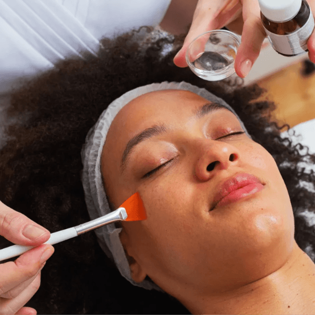 Corrective Chemical Peel Series at Bare+Skin in Shreveport, LA